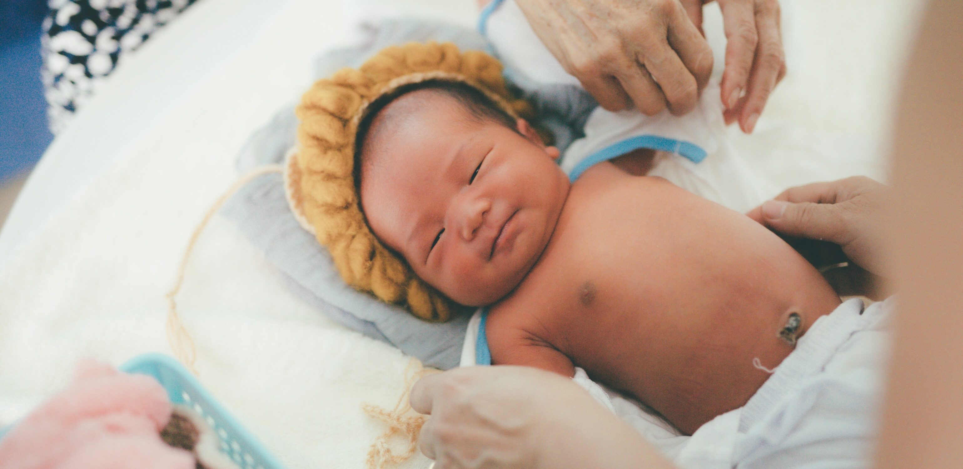 Breastfeeding and Jaundice